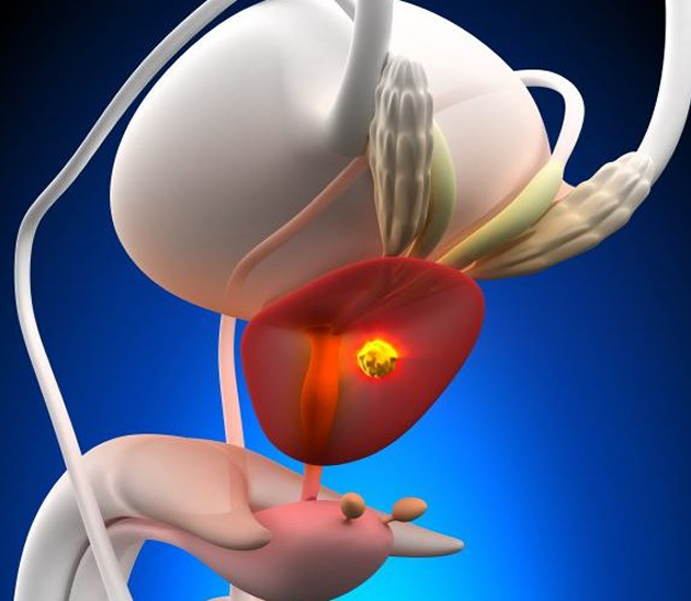 Active Surveillance Hero Image