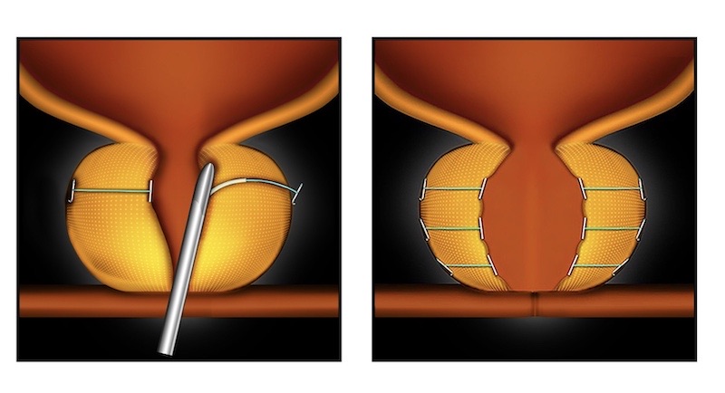 5EECC979 B7CA 41D7 9C52 6BDD1F547F88 1 201 a