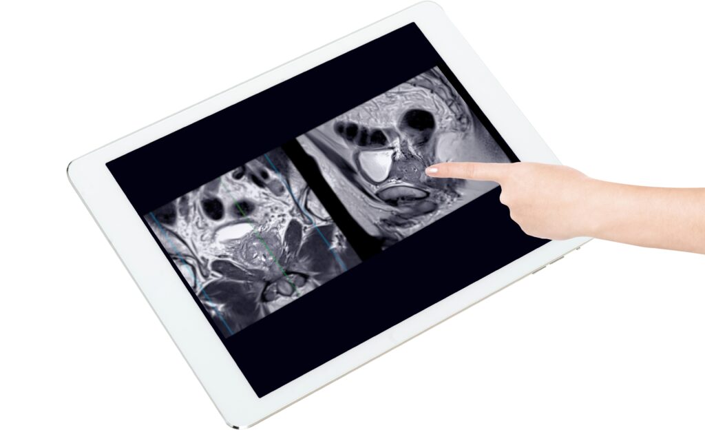 prostate pointing MRI