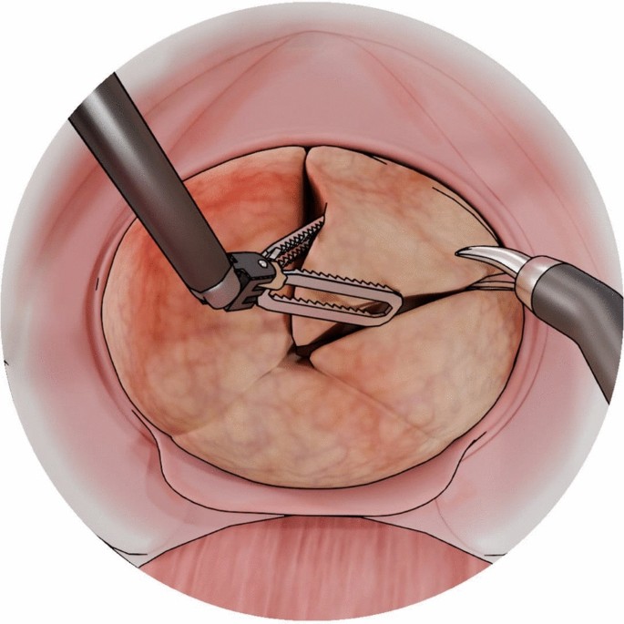 robotic simple graphic